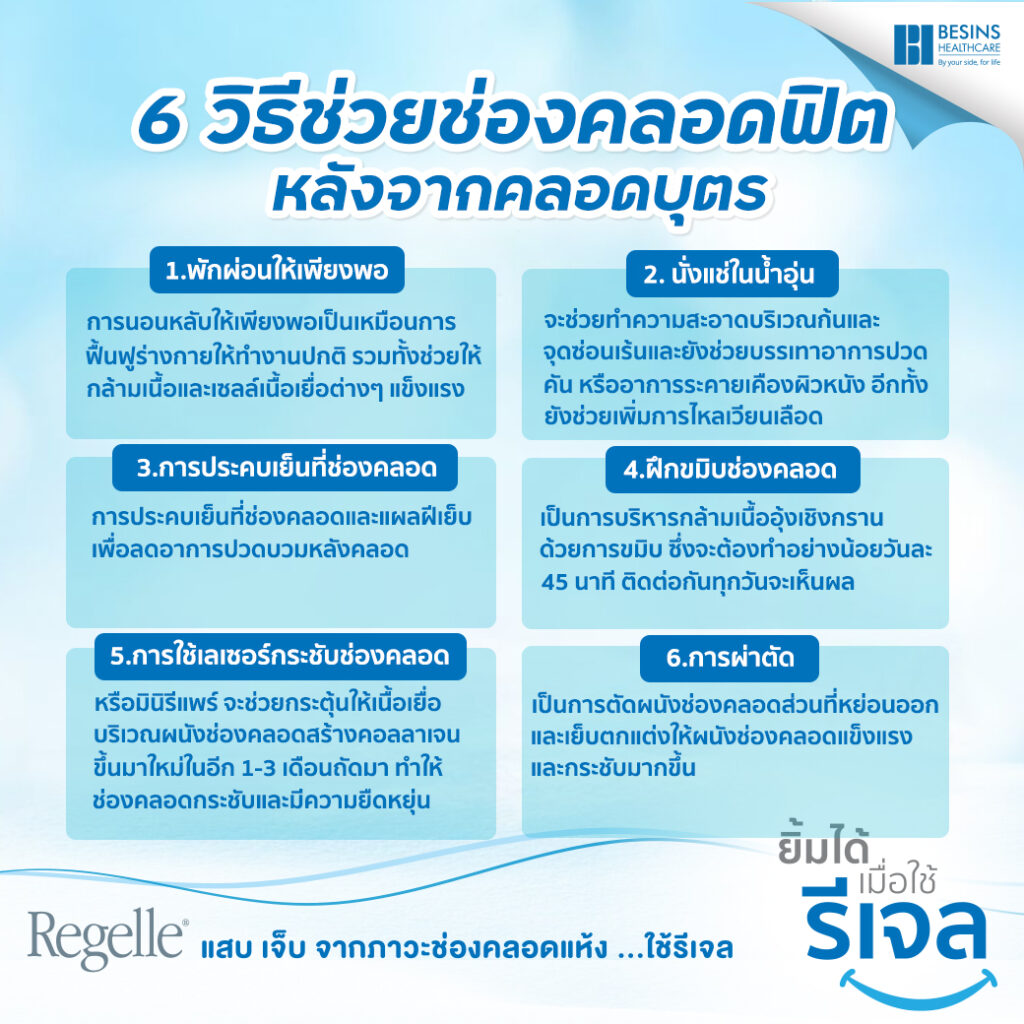 ช่องคลอดฟิตหลังคลอด